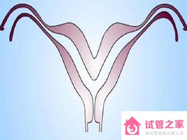 女性先天性幼稚子宮加多囊*巢要怎么治療才能生育？