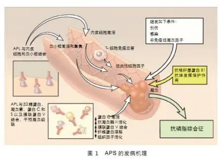 做試管嬰兒前是否有必要檢查自身免疫抗體?自身免疫抗體對妊娠結(jié)局的影響及分析 ...