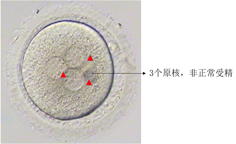 試管嬰兒胚胎的發(fā)育過程，胚胎的評估與試管嬰兒成功率的關(guān)系 ...