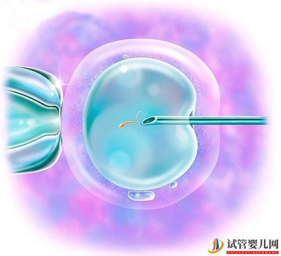 第三*試管嬰可以排除染色體異常嗎