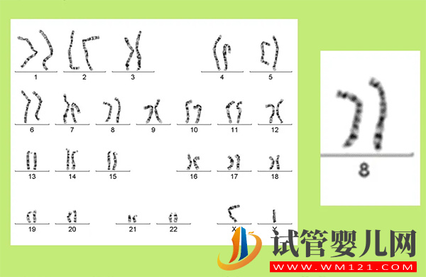 8號染色體異常會怎樣 - 偏多、缺失、三體是什么原因