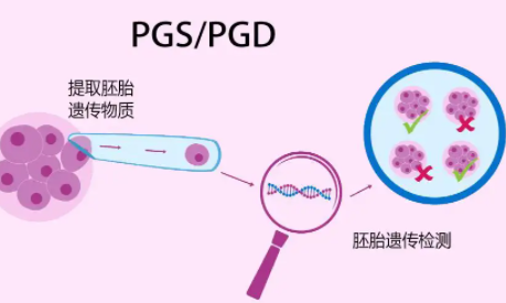 男性最佳生育年齡是多少？高齡男性該如何備孕? 高齡男性試管嬰兒助孕 ...