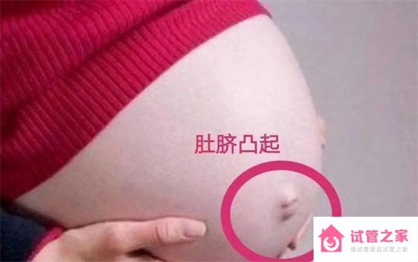 孕婦肚臍有凹有凸，和生男生女有關(guān)？