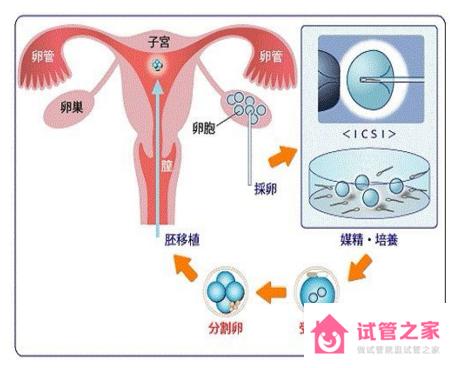 試管嬰兒費用高不高和基因篩查的費用