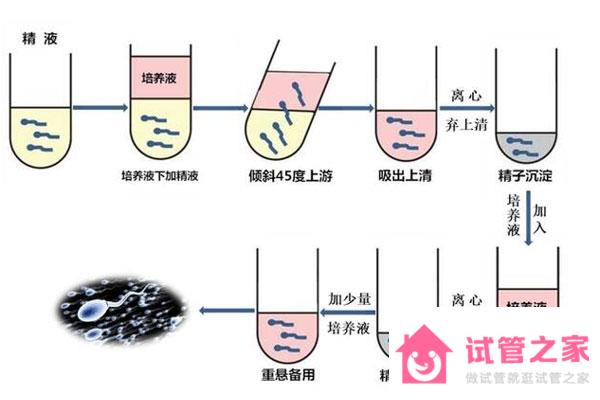 什么是XY精子分離術(shù)？第三*試管和XY精子分離術(shù)的區(qū)別