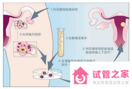 停經(jīng)能不能做供*試管？要想提高成功率需滿足這四個條件