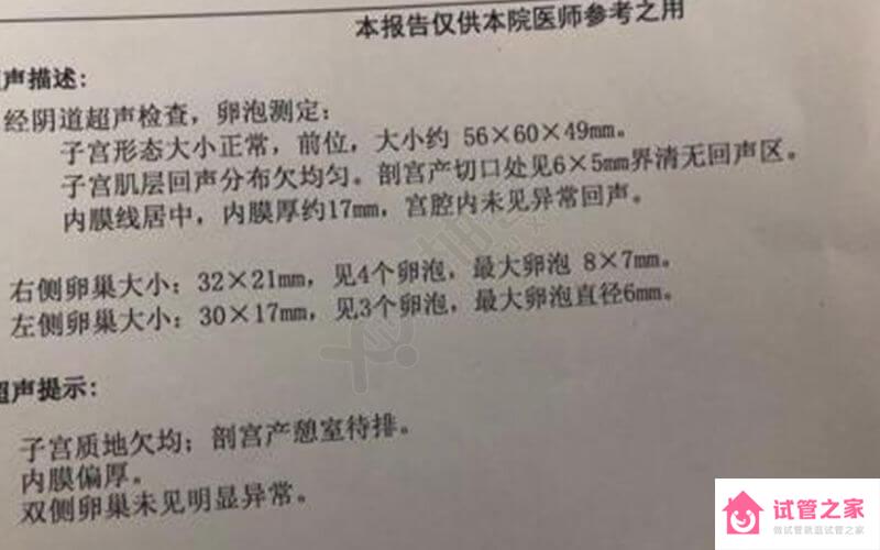 輸*管粘連試管1次成功，她不靠孕氣靠方法