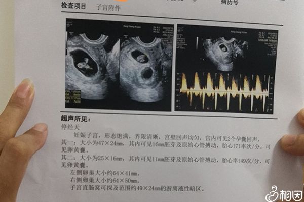 44歲做試管生雙胞胎別只看能否成功了，胎停風(fēng)險(xiǎn)多大要早知