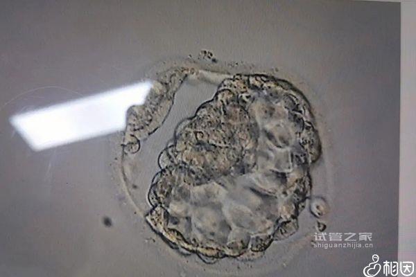 子宮內(nèi)膜11a移植成功率解析，好不好、適不適合著床看這