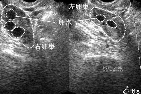 別管5個基礎*泡能取多少了，先看看最多可以促幾個再說