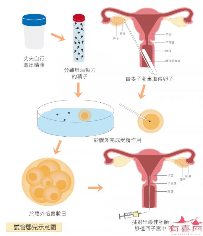 體外受精與試管嬰兒的區(qū)別是什么