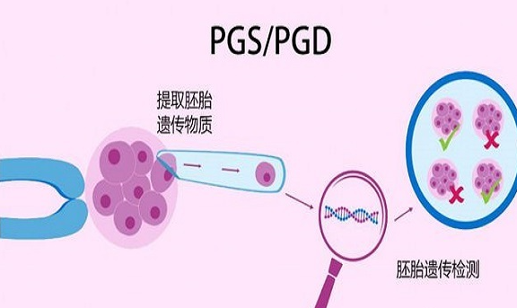 廣州和深圳醫(yī)院的三*試管包生男孩的價格清單