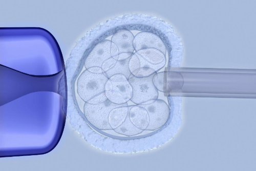 試管嬰兒可以進(jìn)醫(yī)保報(bào)銷嗎？需了解不同地區(qū)政策