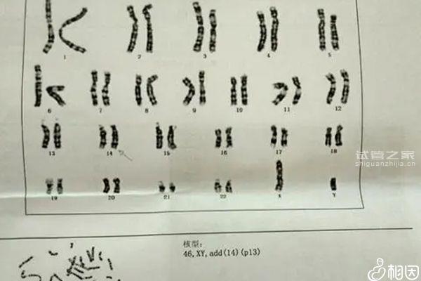 貴陽胚胎染色體檢查價(jià)格公布，想造南明哪個(gè)又好又便宜戳