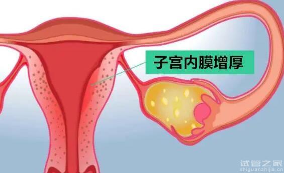 子宮憩室可以做試管嗎費(fèi)用一般多少？