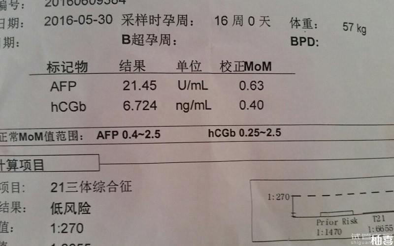 唐篩兩個數(shù)據(jù)大于1生男孩說不準！報告單看性別可信度不高