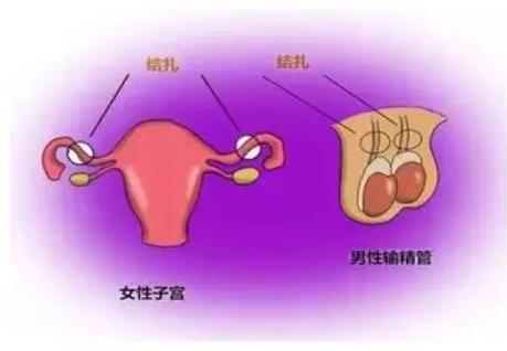 輸卵管結(jié)扎了還會(huì)自然懷孕嗎？做試管懷孕要多少錢？