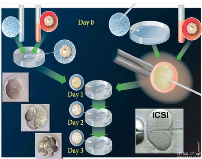 試管嬰兒二代精卵結(jié)合需要幾天，附精子和卵子培養(yǎng)過程
