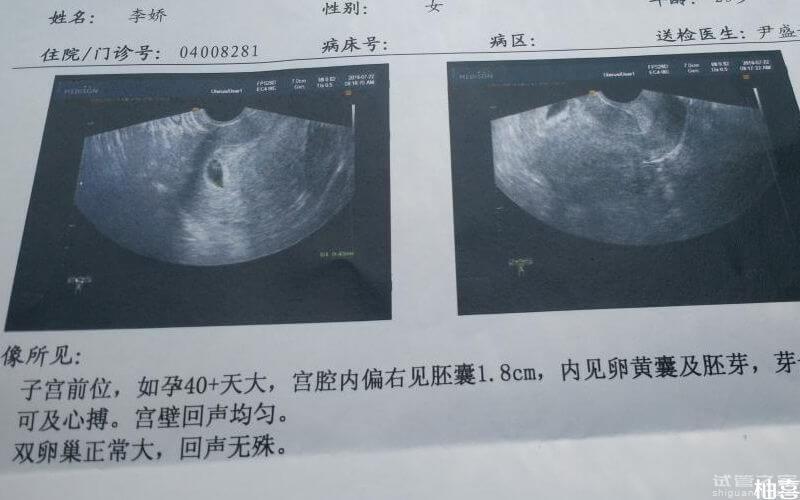 測(cè)生男生女的方法比比皆是，真正科學(xué)的就兩個(gè)