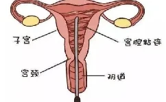 卵巢囊腫的照片：卵巢囊腫照片ct?