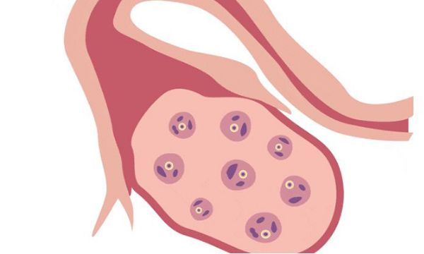 促排取卵時(shí)優(yōu)勢(shì)卵泡為啥老在一側(cè)?