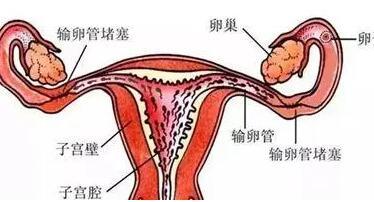 輸卵管結(jié)核能自然受孕嗎費用一般多少？