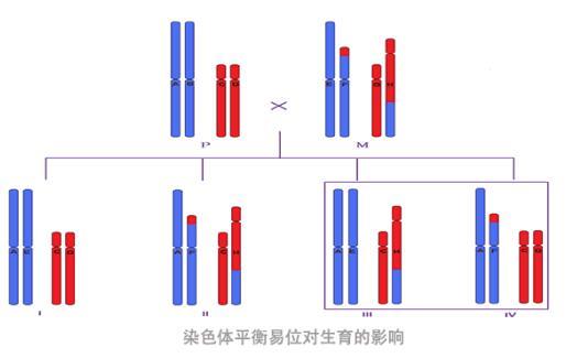 羅氏易位平衡易位做試管哪個好一點？