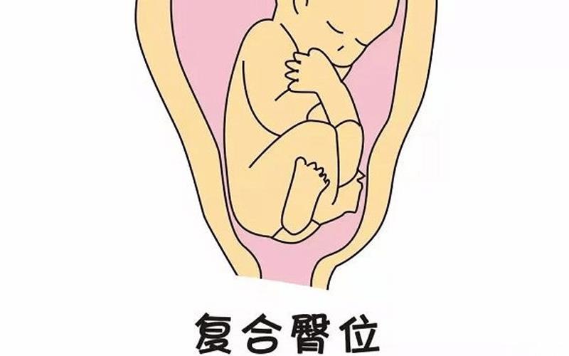 女性分娩別盲目用催產(chǎn)針！這3類孕婦千萬(wàn)不能碰