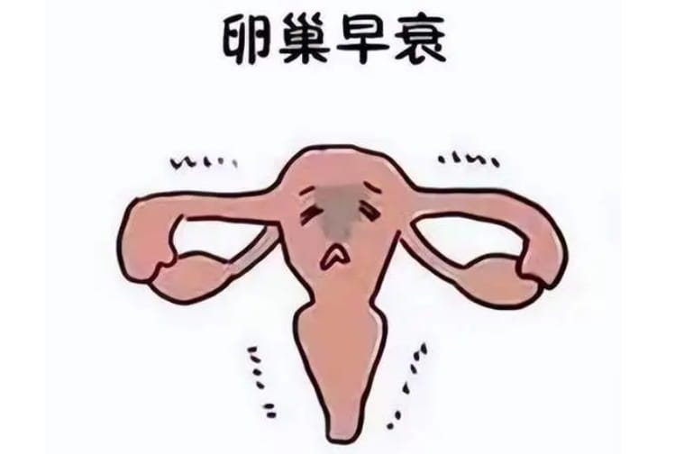 什么是卵巢早衰？女性卵巢早衰的表現(xiàn)是什么？卵巢早衰的女性是否看起來特別顯老？-試 ...