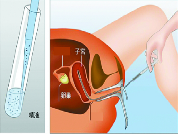 美國與國內(nèi)試管嬰兒醫(yī)生對(duì)比，哪個(gè)好看完就知道