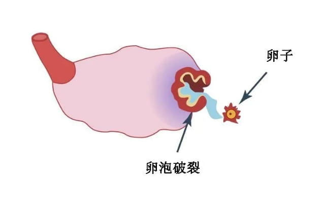 這三類人群，可以考慮一個促排周期取兩次卵！-試管嬰兒網(wǎng)