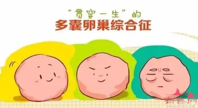 ?多囊卵巢能治好嗎