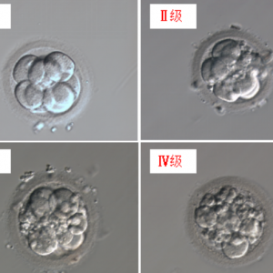 試管嬰兒移植的胚胎能看出來男女嗎？