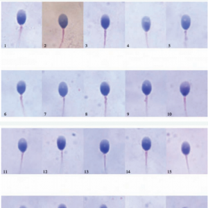 什么樣才算正常精子形態(tài)？異常精子和正常精子都是長什么樣子的？ 