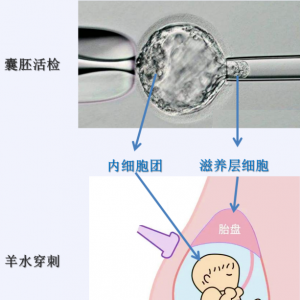 第三*試管嬰兒技術(shù)PGT的缺陷缺點