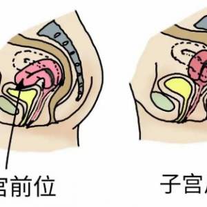 子宮前位和后位那種更容易受孕？