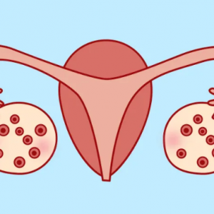 揭秘：多囊*巢綜合征對試管嬰兒成功率到底有多大影響？