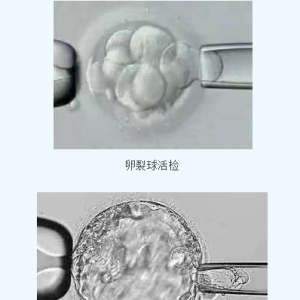 第三*試管嬰兒技術(shù)阻斷地中海貧血等遺傳病