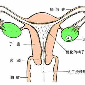 在省婦幼青山湖院區(qū)，我終于懷了！